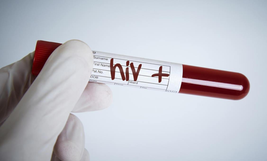 Over 13,000 people living with HIV in Tajikistan: majority are adult men