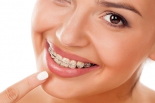 Сколько стоит поставить брекеты в Таджикистане и где это лучше делать?